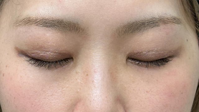 手术前的状态 其一