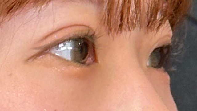 手术前的状态 其一