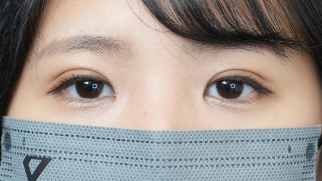 手术前的状态 其一