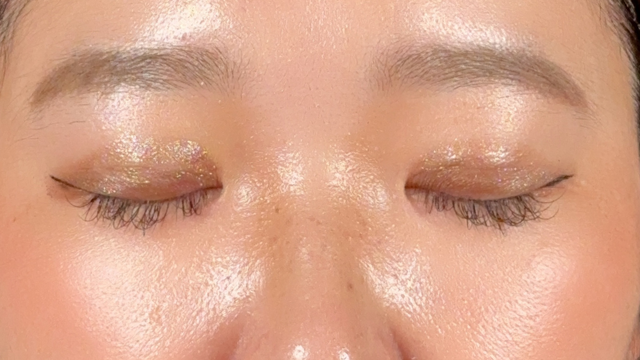 手术前的状态 其一