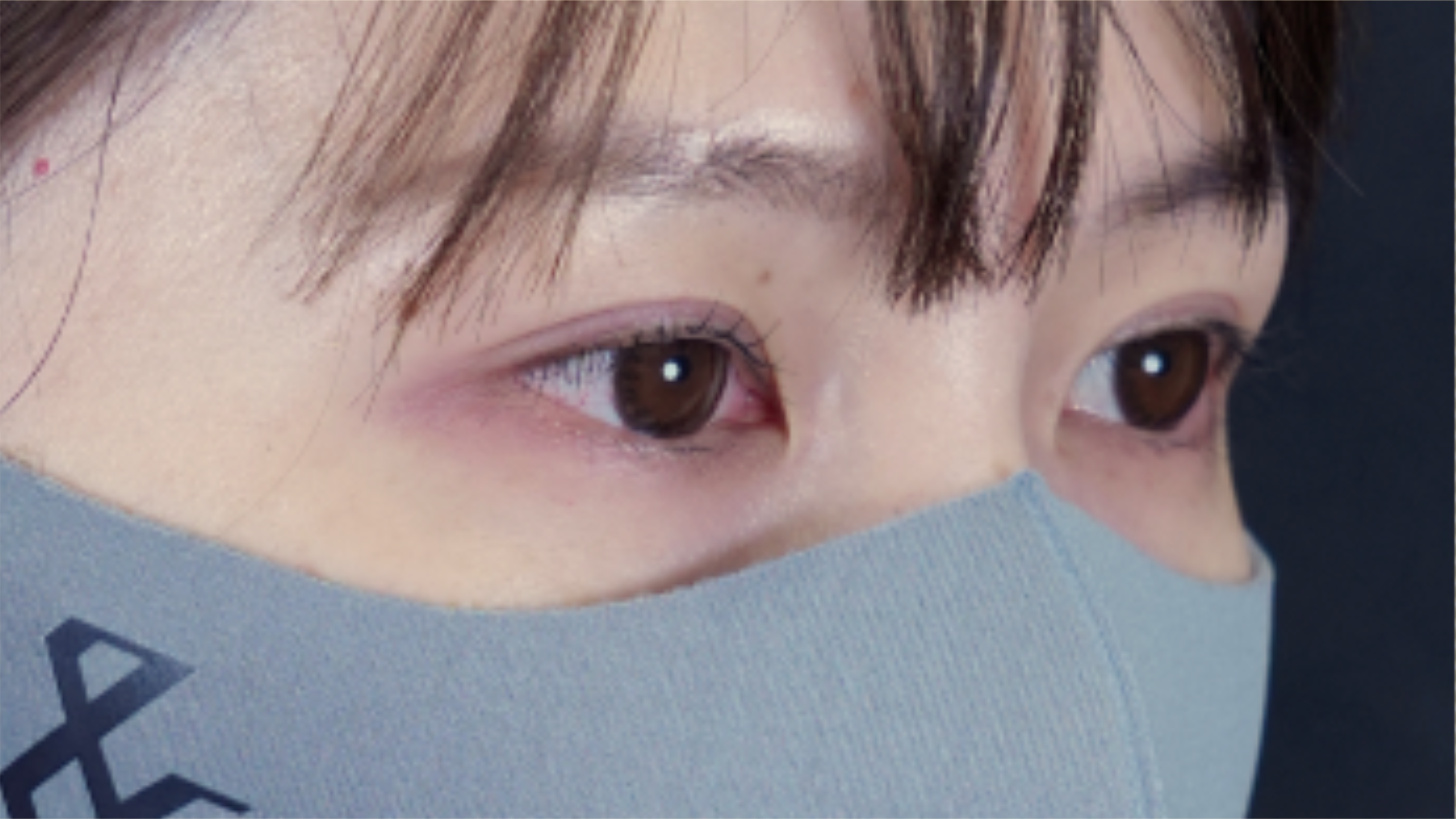 手术前的状态 其一