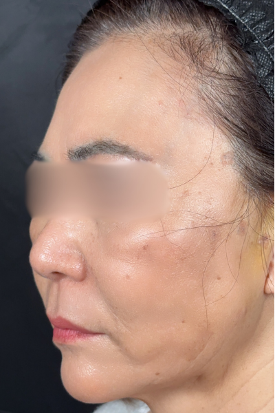 手術前の状態 その1