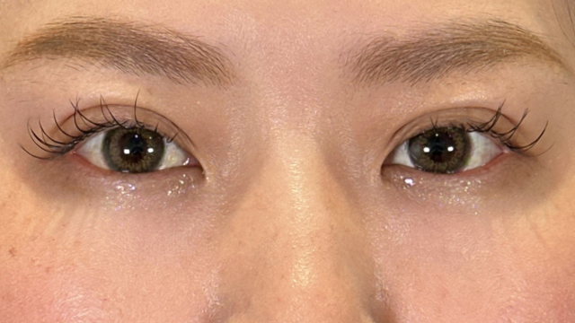 手术前的状态 其一