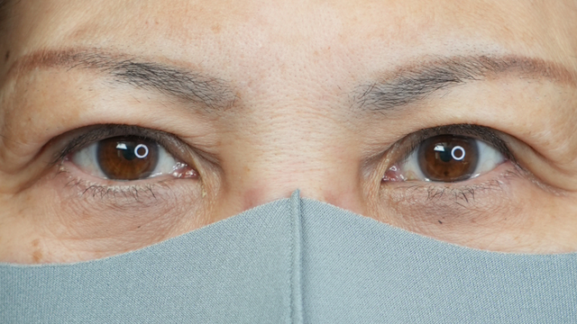 手术前的状态 其一