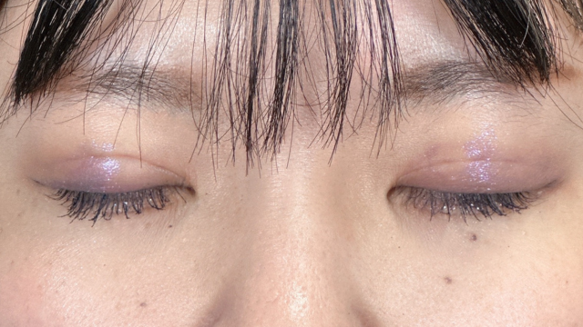 手术前的状态 其一