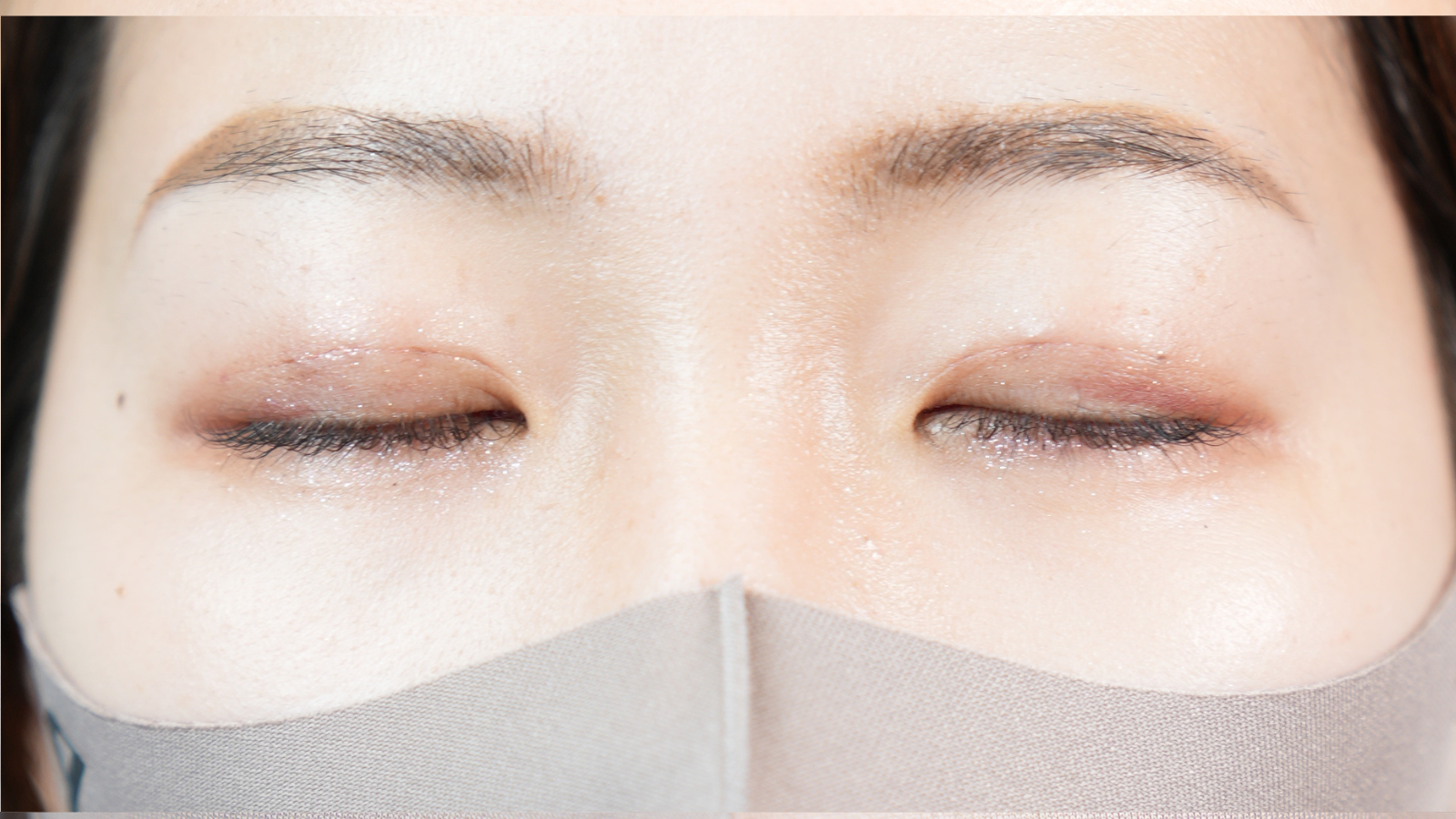 手術前の状態 その1