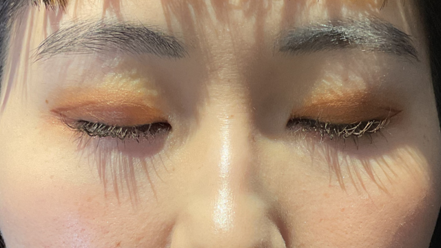 手术前的状态 其一