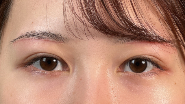 Postoperative Condition Part 1