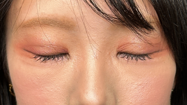 手术前的状态 其一