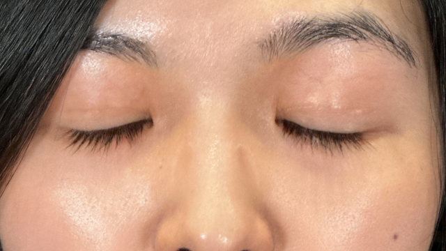 手术前的状态 其一