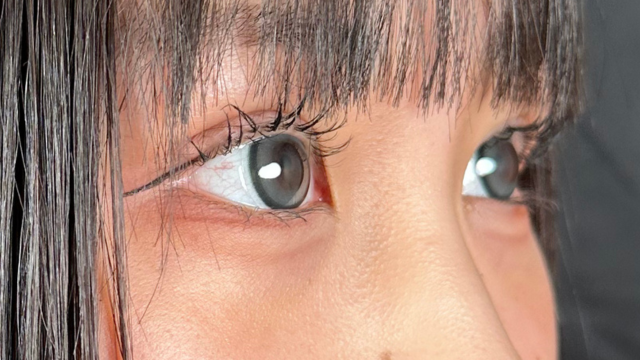 手术前的状态 其一