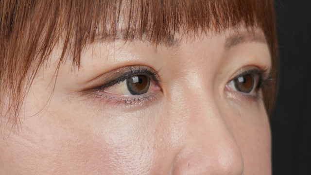 手术前的状态 其一