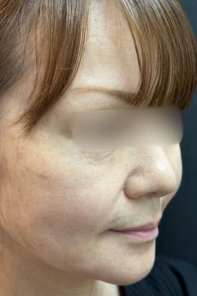 手術前の状態 その1