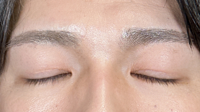 手術前の状態 その1