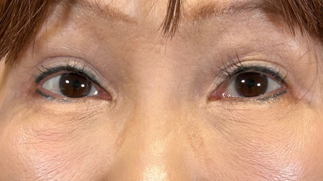 手术前的状态 其一