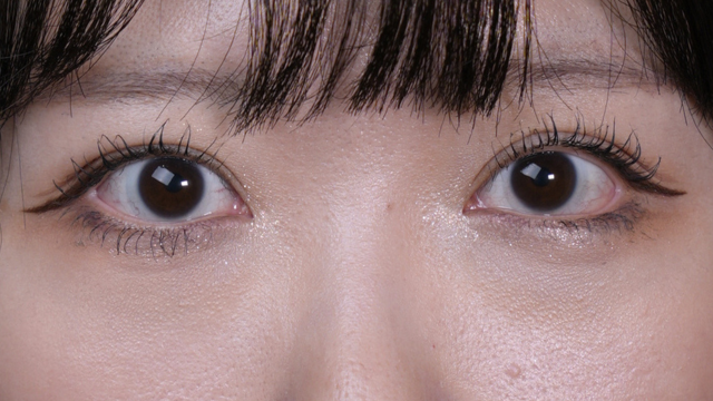 手术前的状态 其一