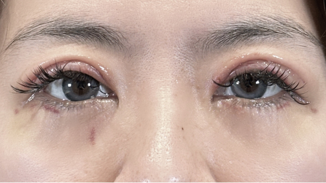 Postoperative Condition Part 1