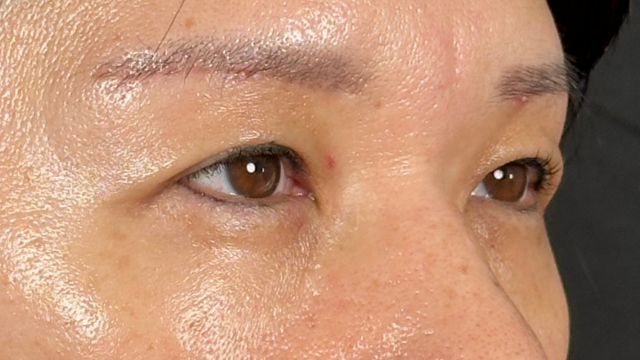 Postoperative Condition Part 1