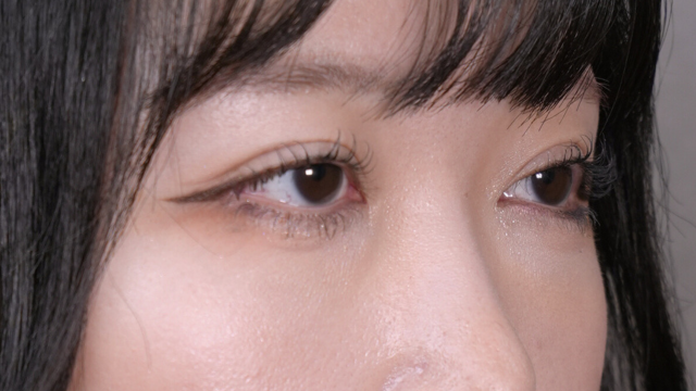 手术前的状态 其一