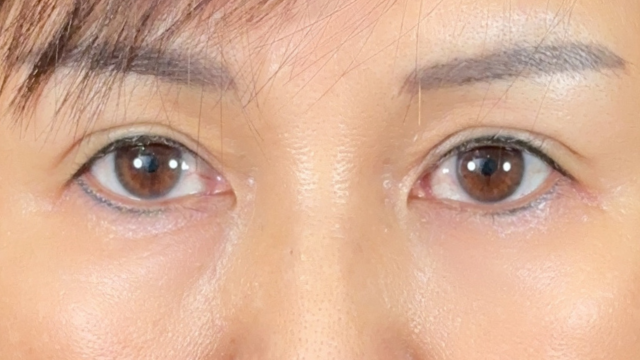 Postoperative Condition Part 1