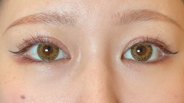 Postoperative Condition Part 1