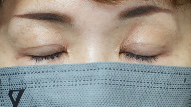 手術前の状態 その1