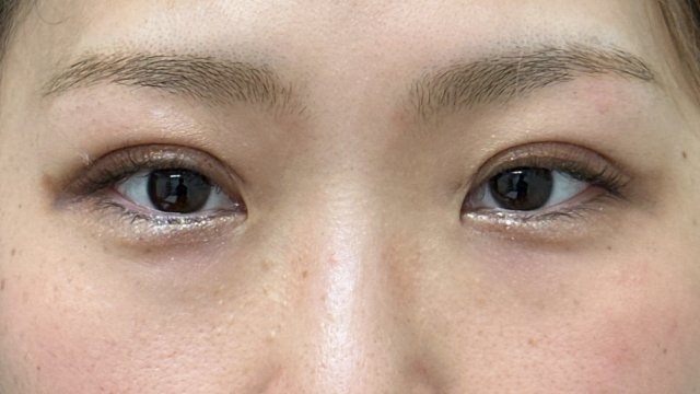 手术前的状态 其一