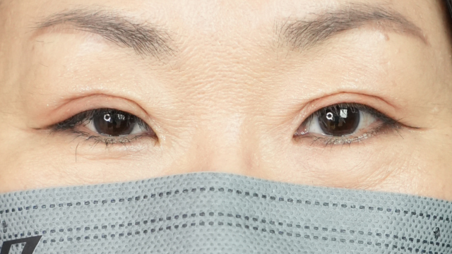 手術前の状態 その1