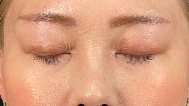 Postoperative Condition Part 1