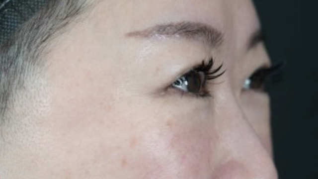 Postoperative Condition Part 1