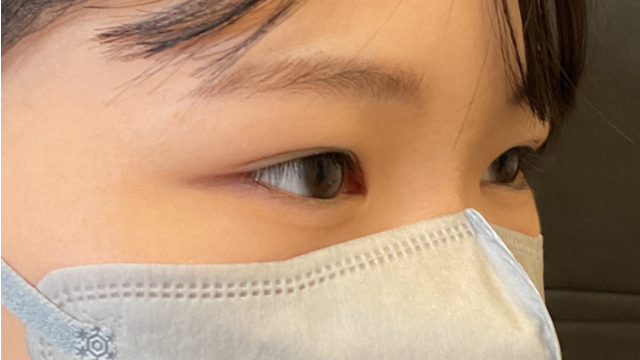 Postoperative Condition Part 1