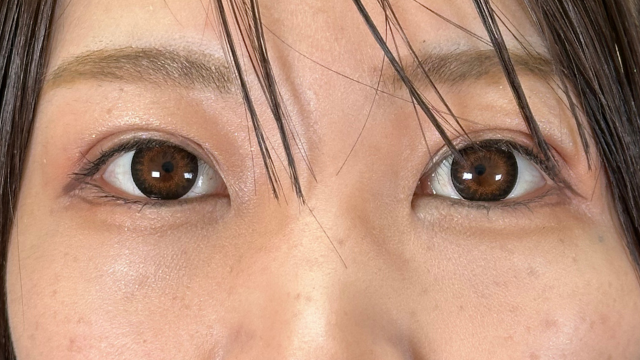 手术前的状态 其一