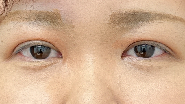 Postoperative Condition Part 1