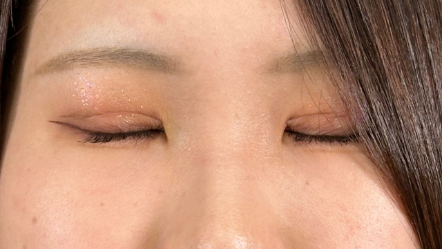 手术前的状态 其一