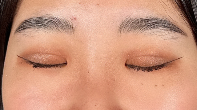 手术前的状态 其一