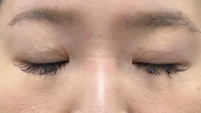 Postoperative Condition Part 1