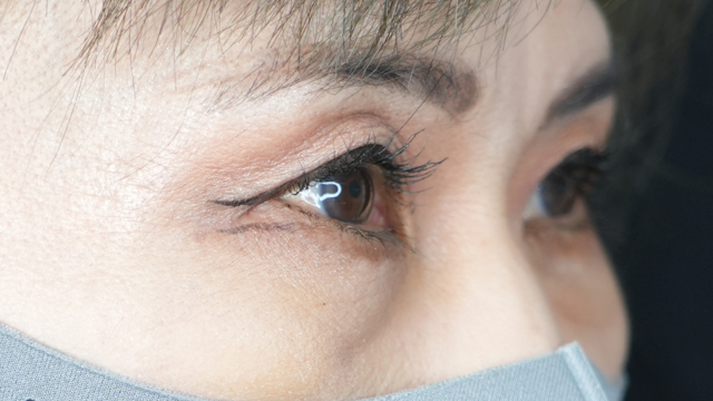 手术前的状态 其一