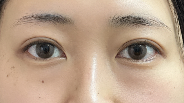 手术前的状态 其一