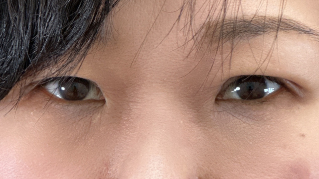 Postoperative Condition Part 1