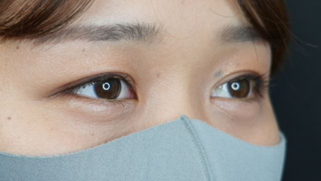 手術前の状態 その1