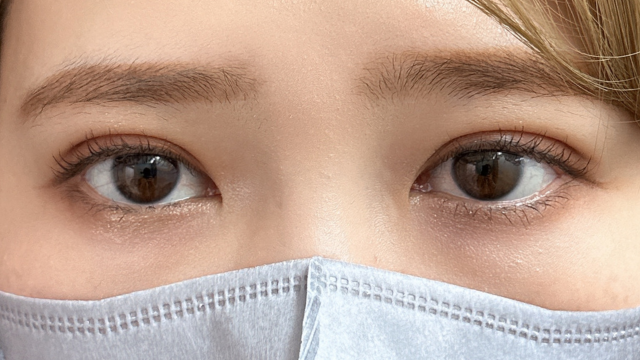 手术前的状态 其一