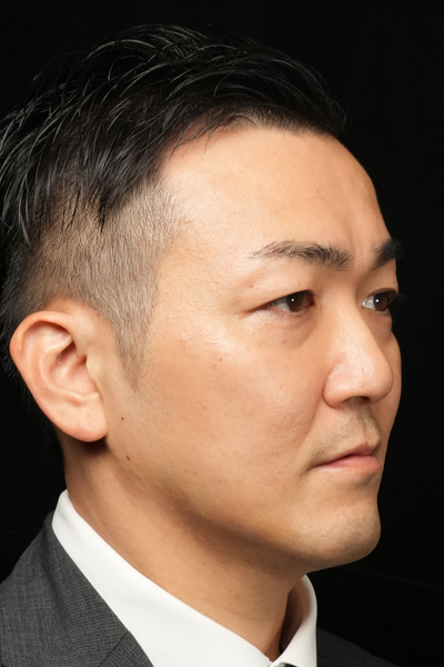 手術前の状態 その1