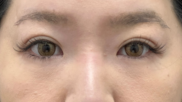 Postoperative Condition Part 1