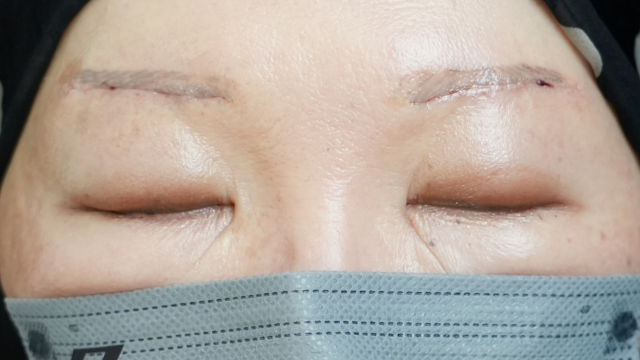 Postoperative Condition Part 1