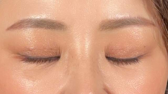 手术前的状态 其一