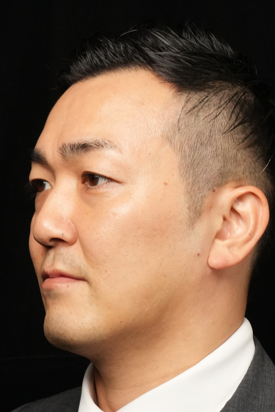 手術前の状態 その1