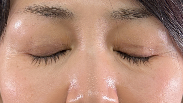 手术前的状态 其一