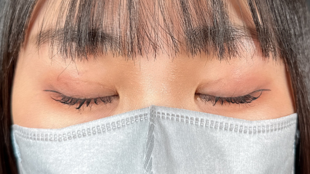 手术前的状态 其一