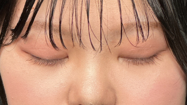 手术前的状态 其一