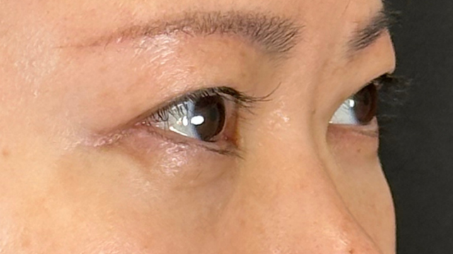 手术前的状态 其一